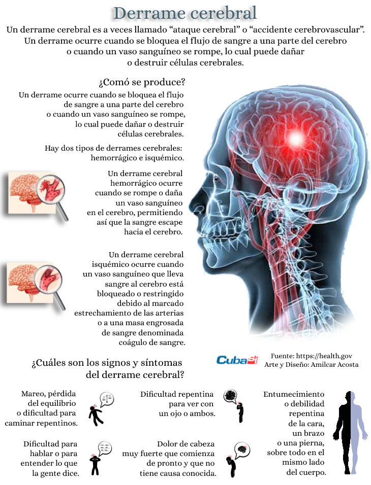 infografia derrame cerebral cubasi 1