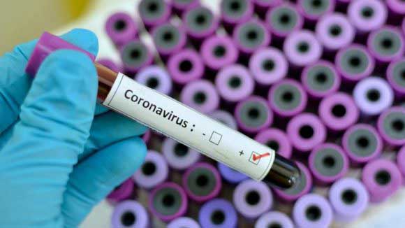 Coronavirus Covid 