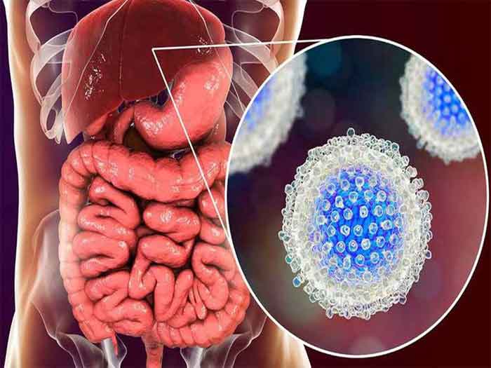 The hepatitis C virus is an almost silent infection because many cases are generally asymptomatic.