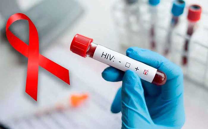 An estimated 2.8 million people were living with HIV in Latin America and the Caribbean in 2024.