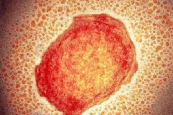 El sistema nacional de Salud de Cuba mantiene hoy un grupo de acciones dirigidas a prevenir y enfrentar el riesgo de propagación de la viruela del mono.