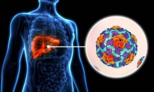 Hepatitis... ¿qué hago? (+infografía)