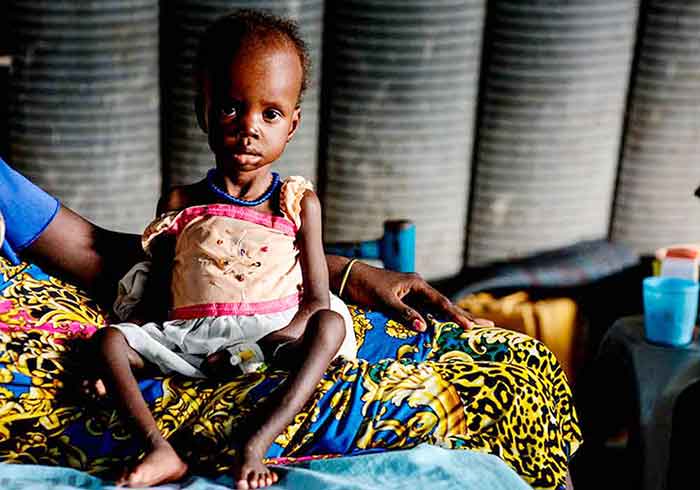 Los niños mueren de hambre a causa del conflicto.