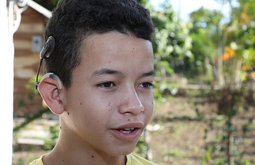 Niño con implante coclear.